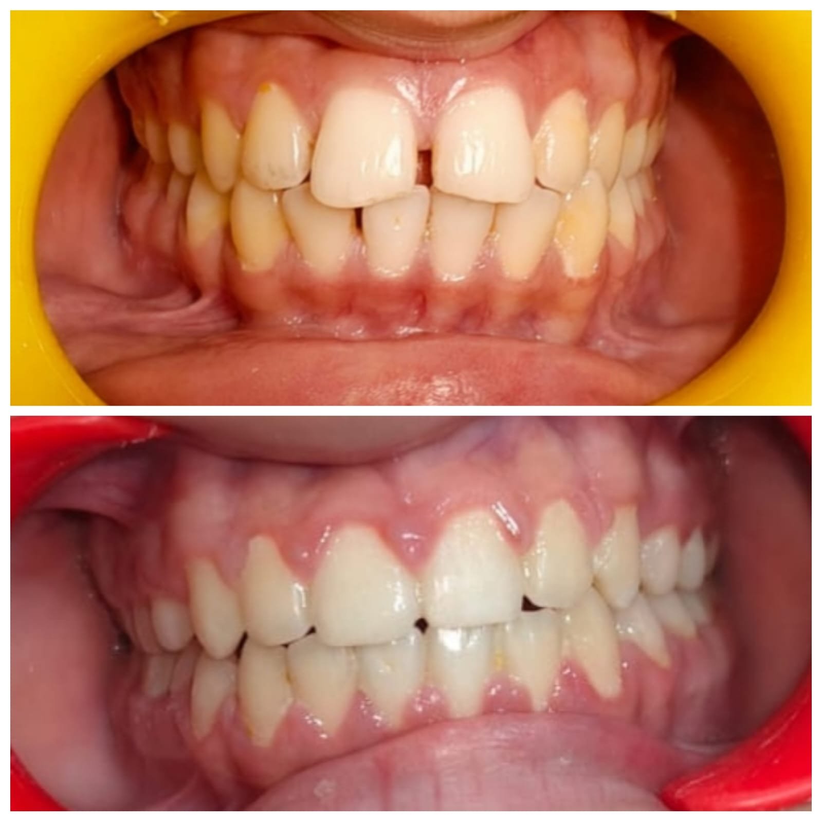 smile makers kota (1)