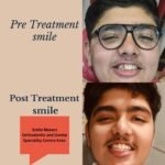 smile makers orthodontic clinic (6)